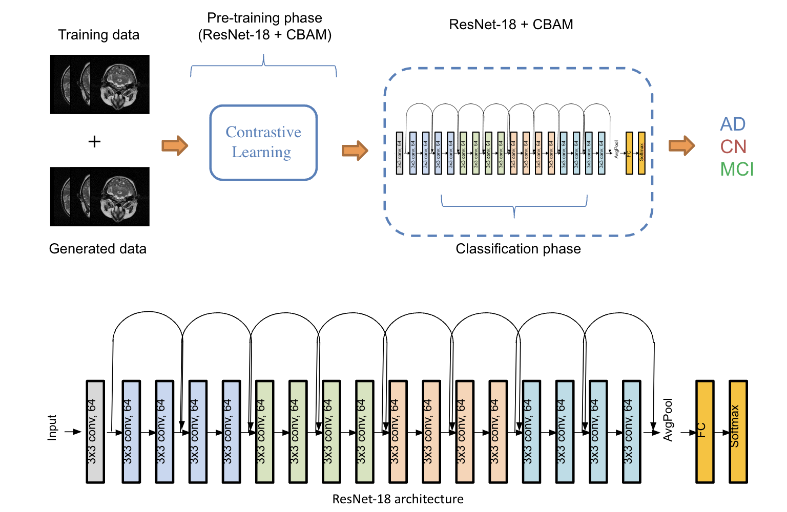 Alzheimer Disease Classification