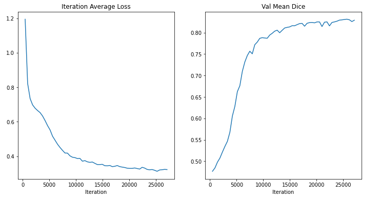3D Artery Segmentation