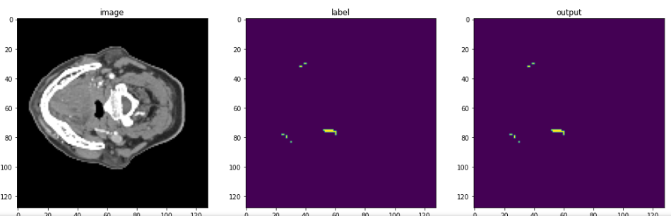 3D Artery Segmentation