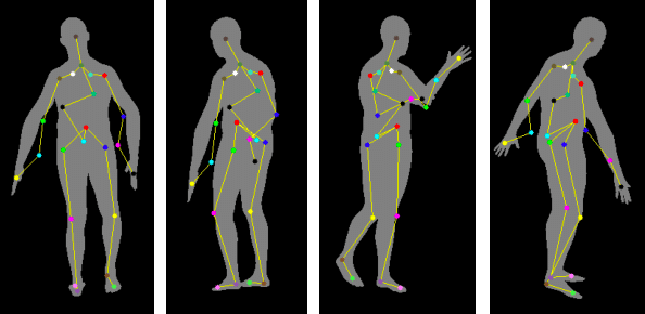 Patient Pose Detection